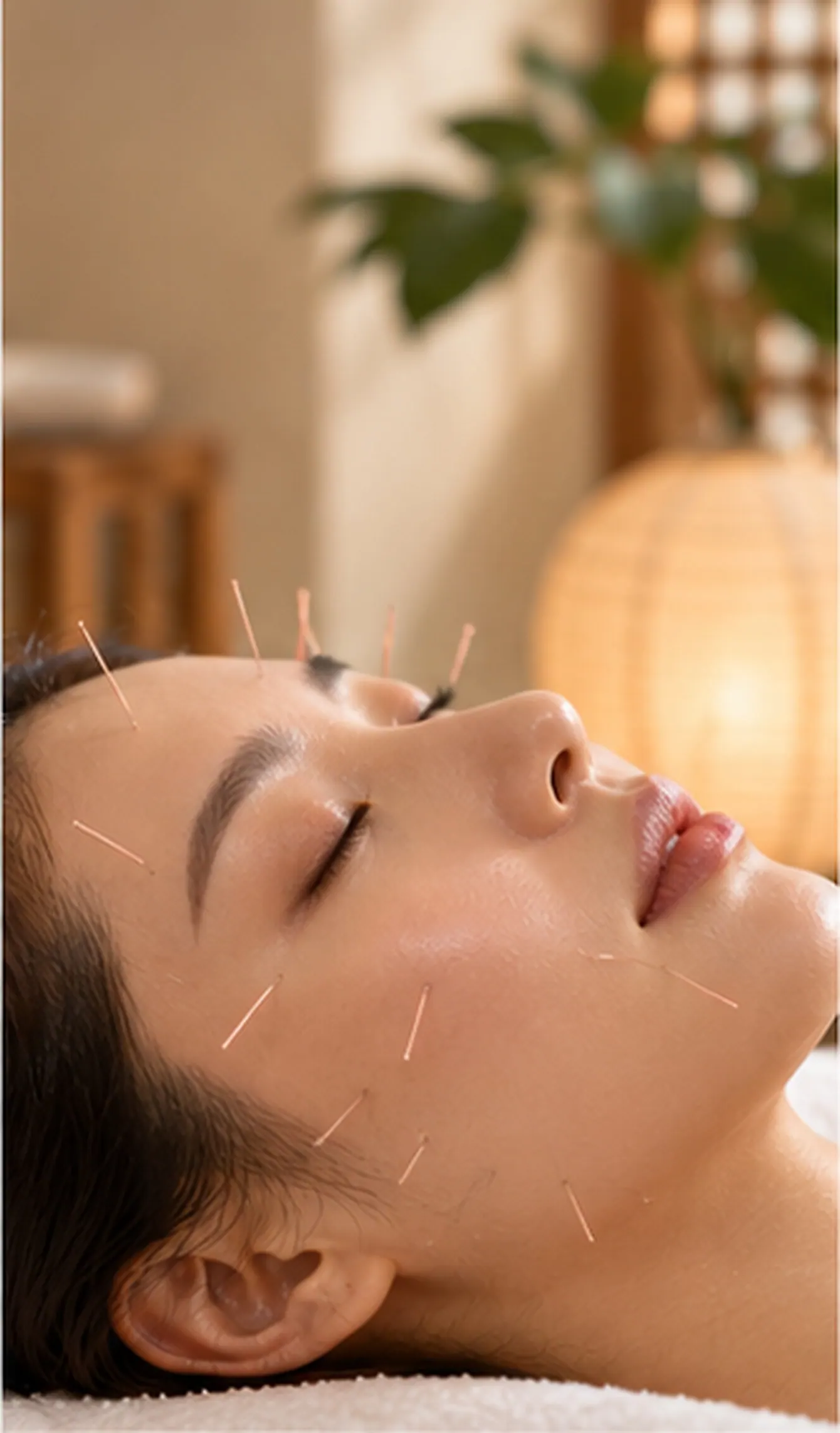Relaxed person receiving a gentle facial acupuncture treatment in a calm room